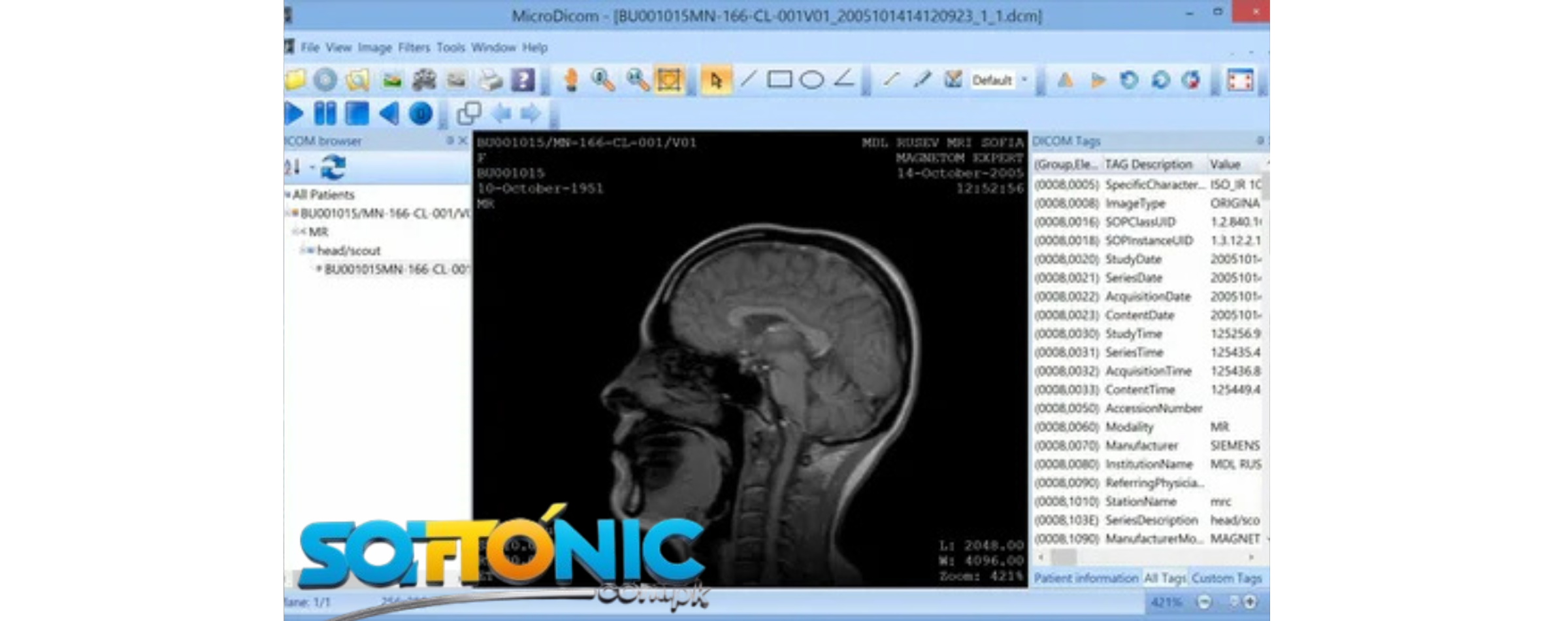 Dicom viewing software mac free download